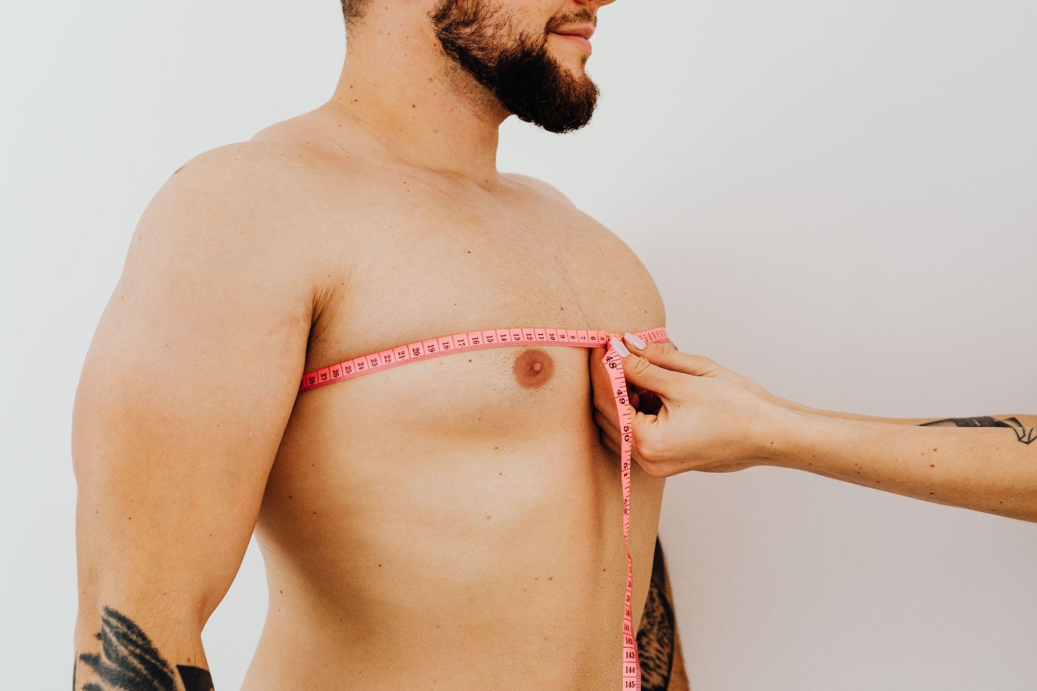 Understanding Gynecomastia: Causes and Treatment Options